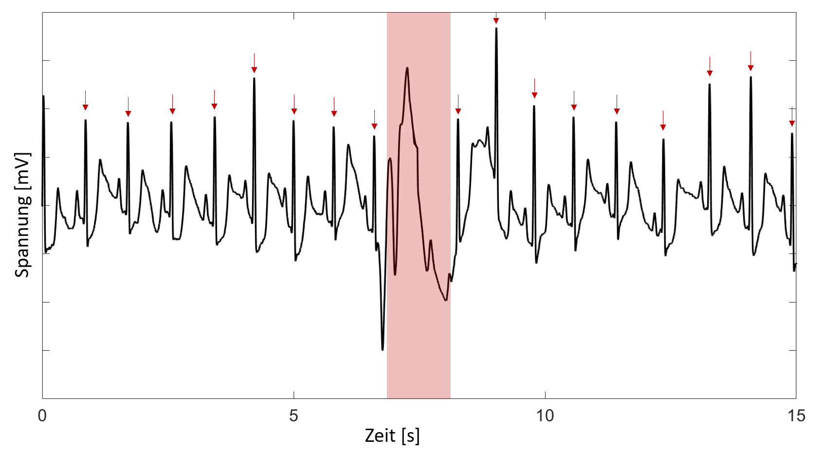 [Translate to 中文:] Fig.3: Artifacts in the EDA signal